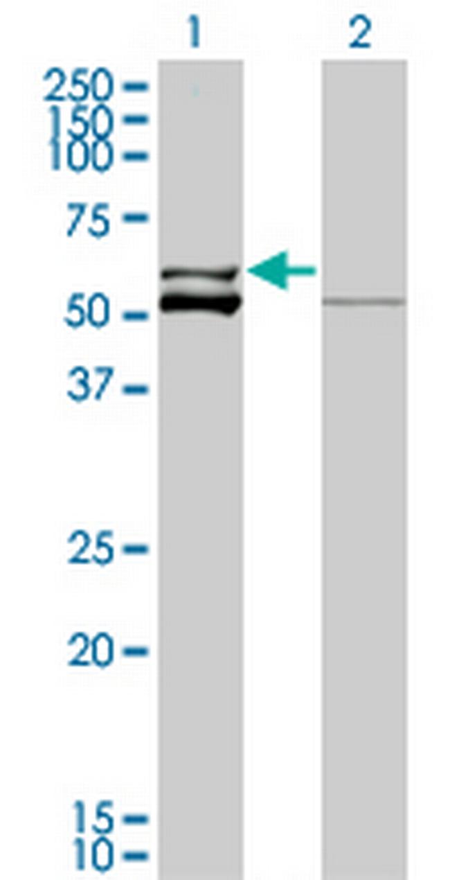 GLUD2 Antibody in Western Blot (WB)