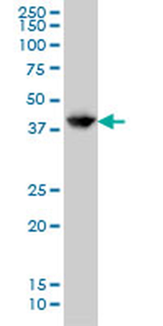 GLUL Antibody in Western Blot (WB)