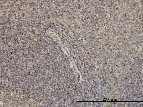 GNAI1 Antibody in Immunohistochemistry (Paraffin) (IHC (P))