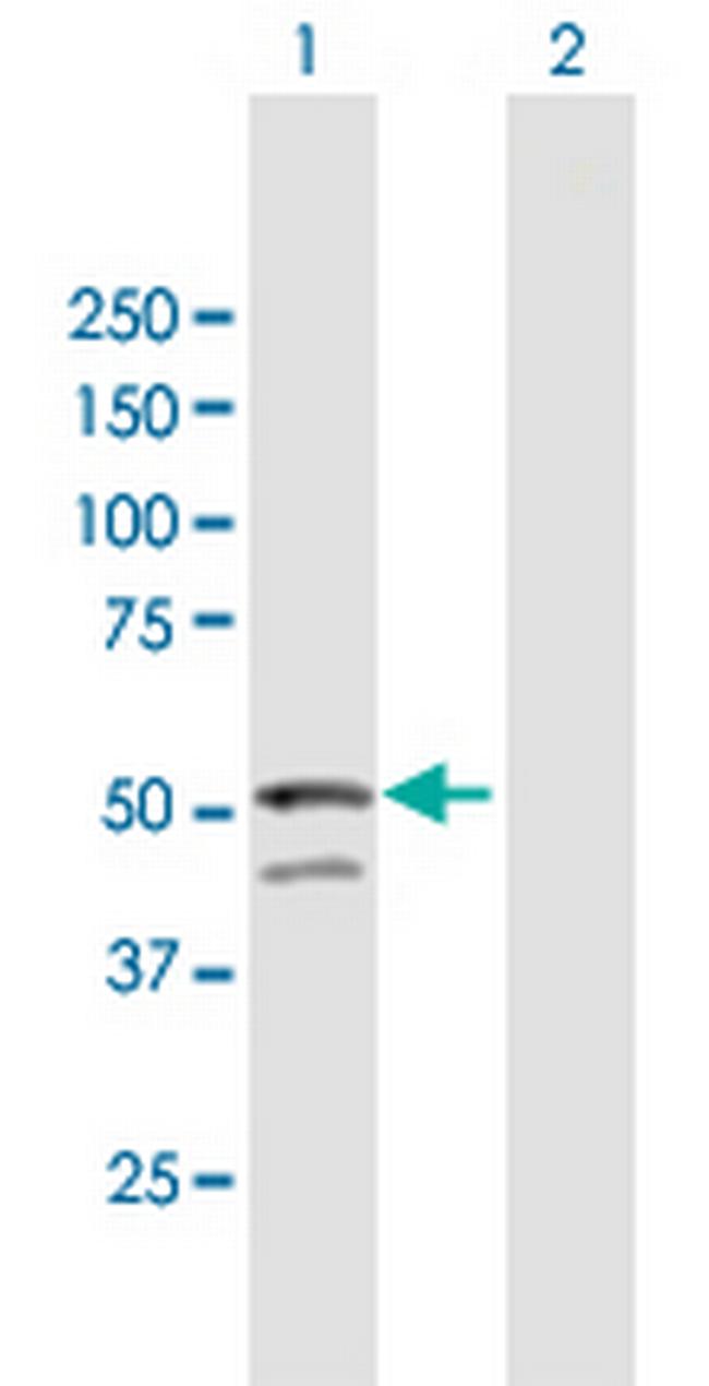 GNAL Antibody in Western Blot (WB)