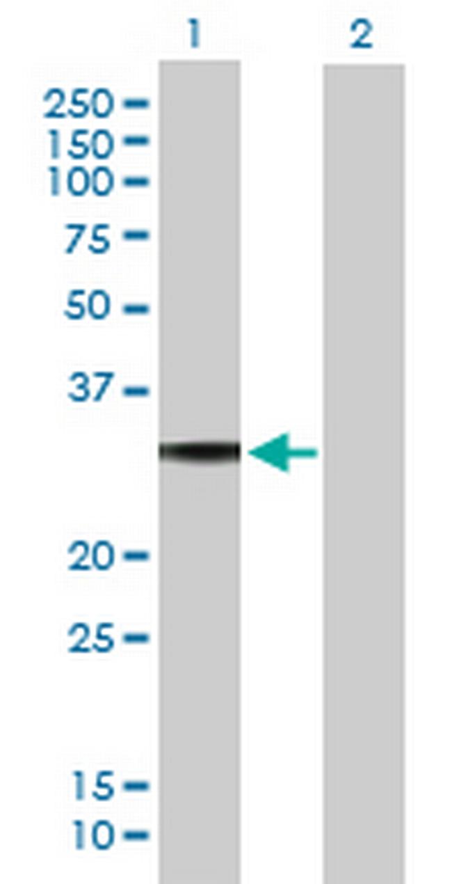 GNAO1 Antibody in Western Blot (WB)