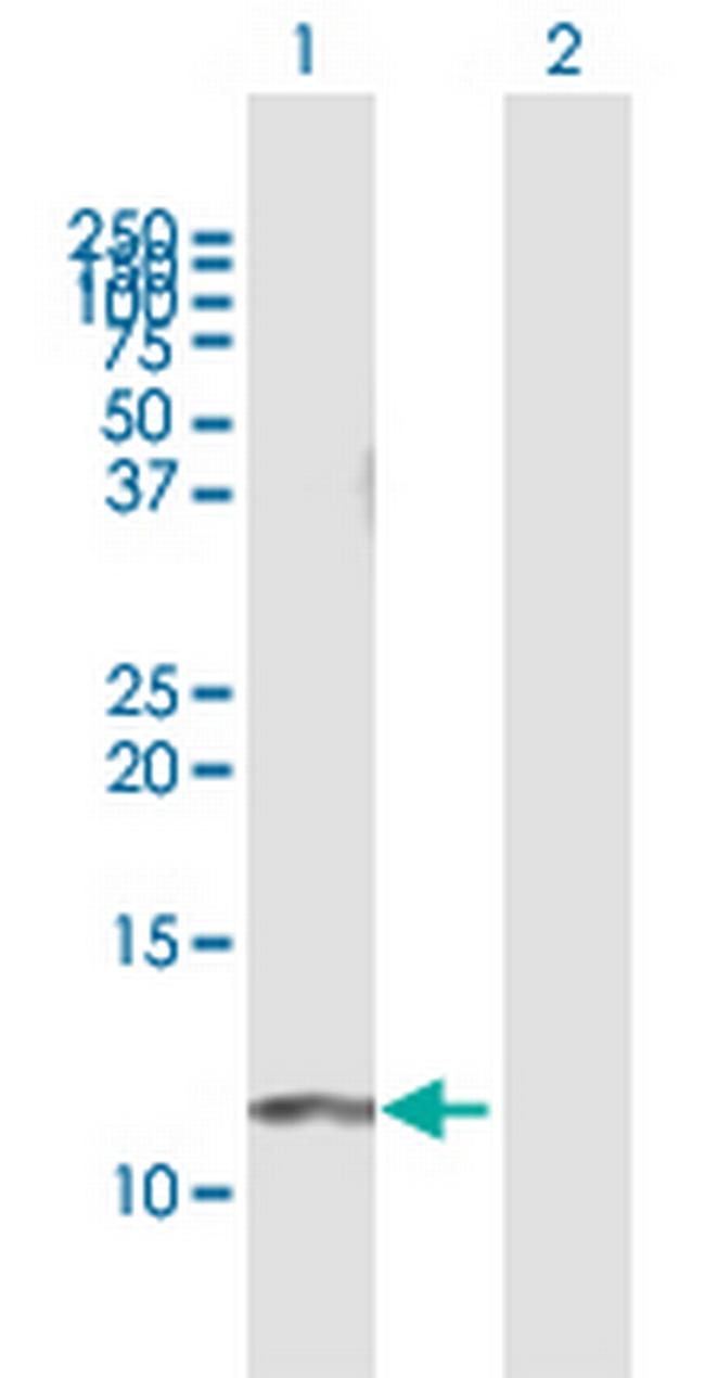 GNG11 Antibody in Western Blot (WB)