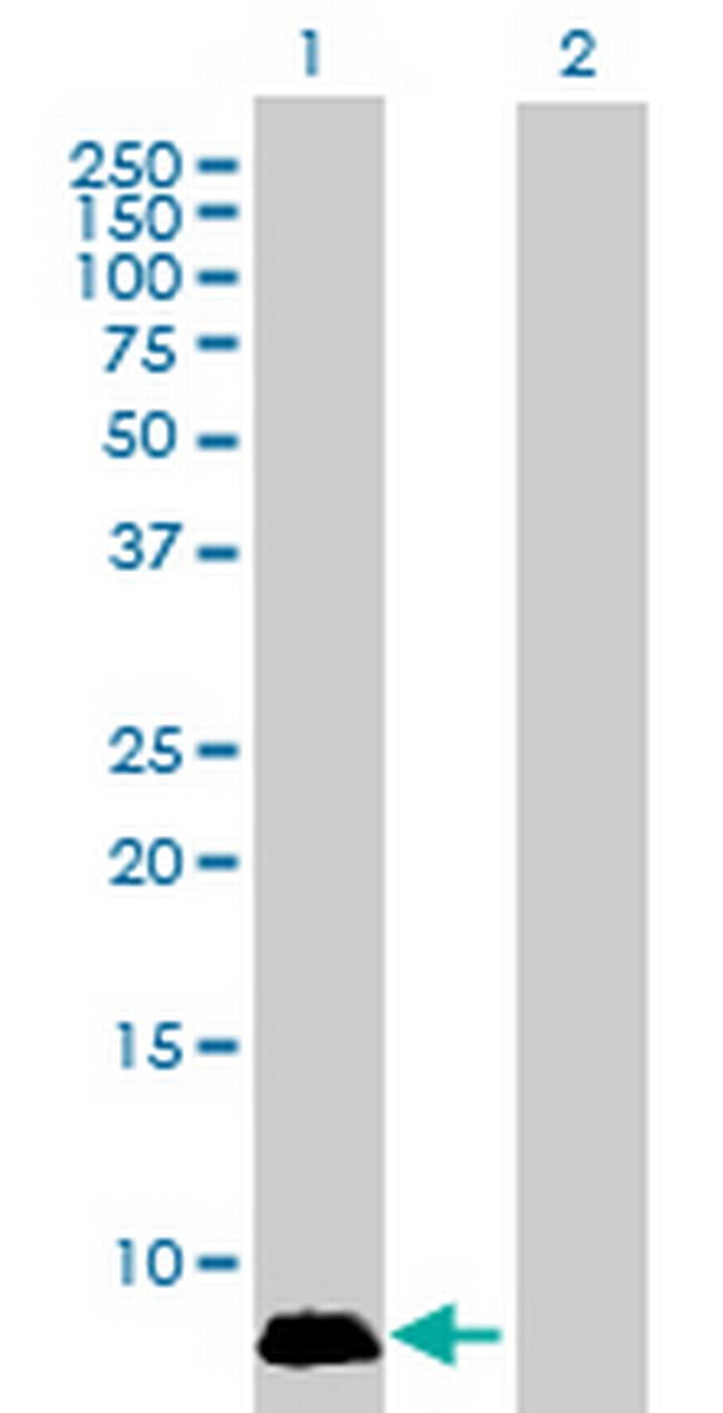 GNGT1 Antibody in Western Blot (WB)