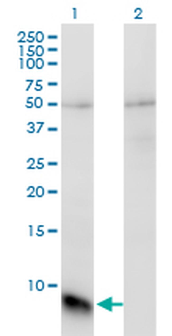 GNGT1 Antibody in Western Blot (WB)