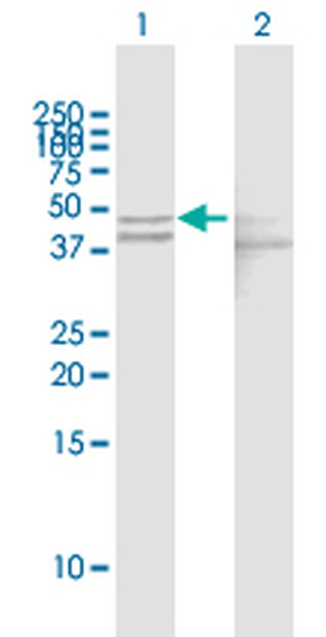 GOT1 Antibody in Western Blot (WB)