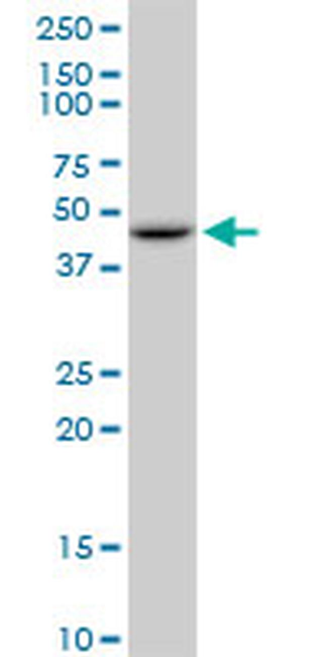 GOT2 Antibody in Western Blot (WB)