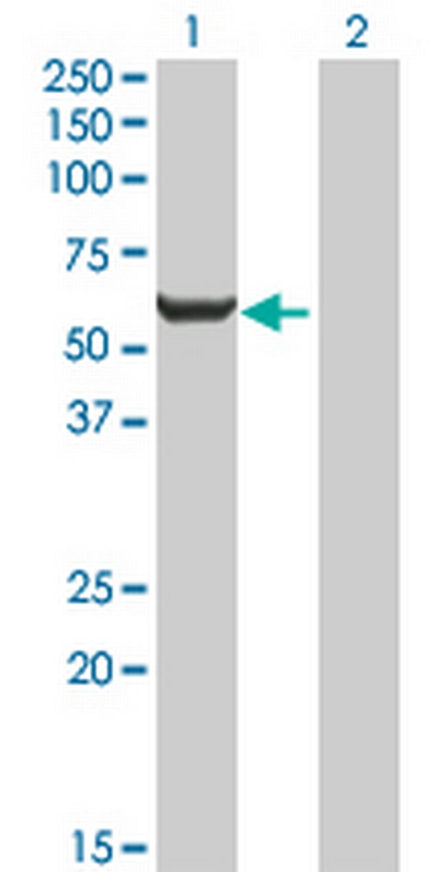 GPI Antibody in Western Blot (WB)
