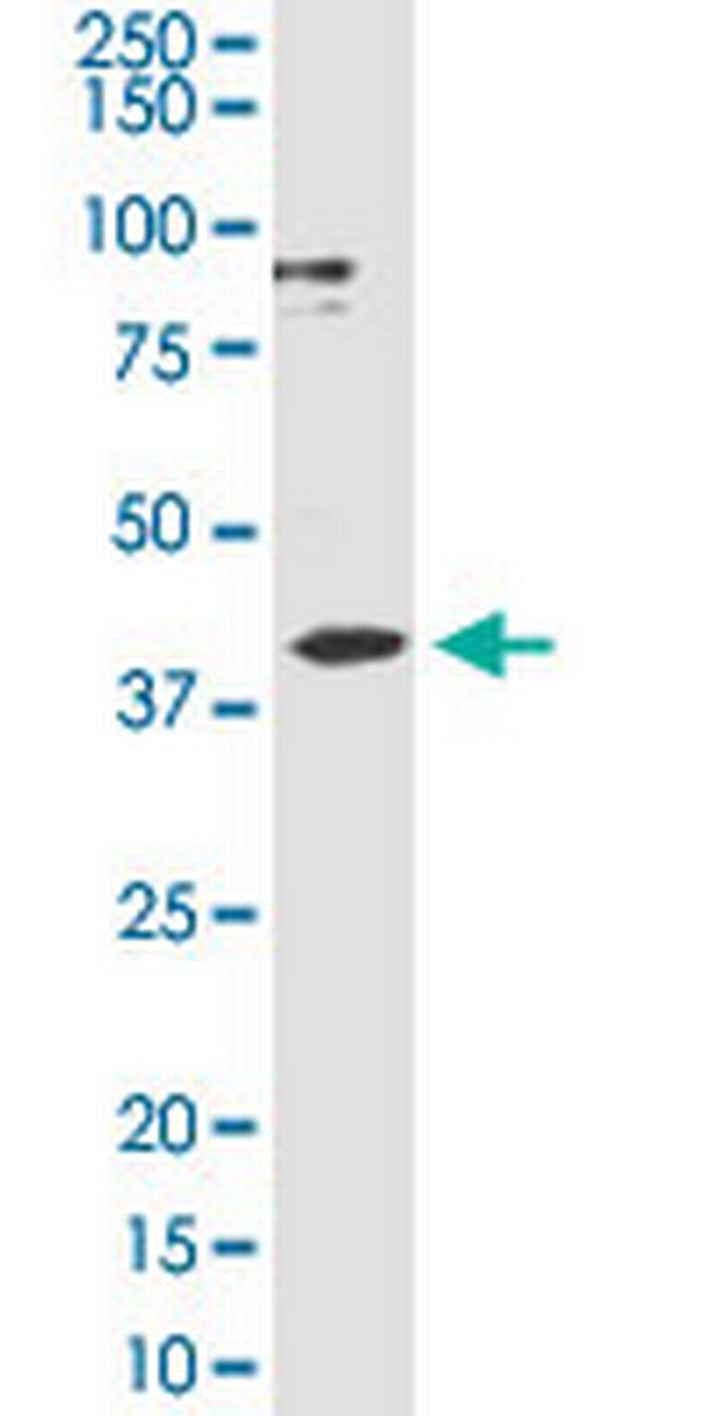 CXCR3 Antibody in Western Blot (WB)