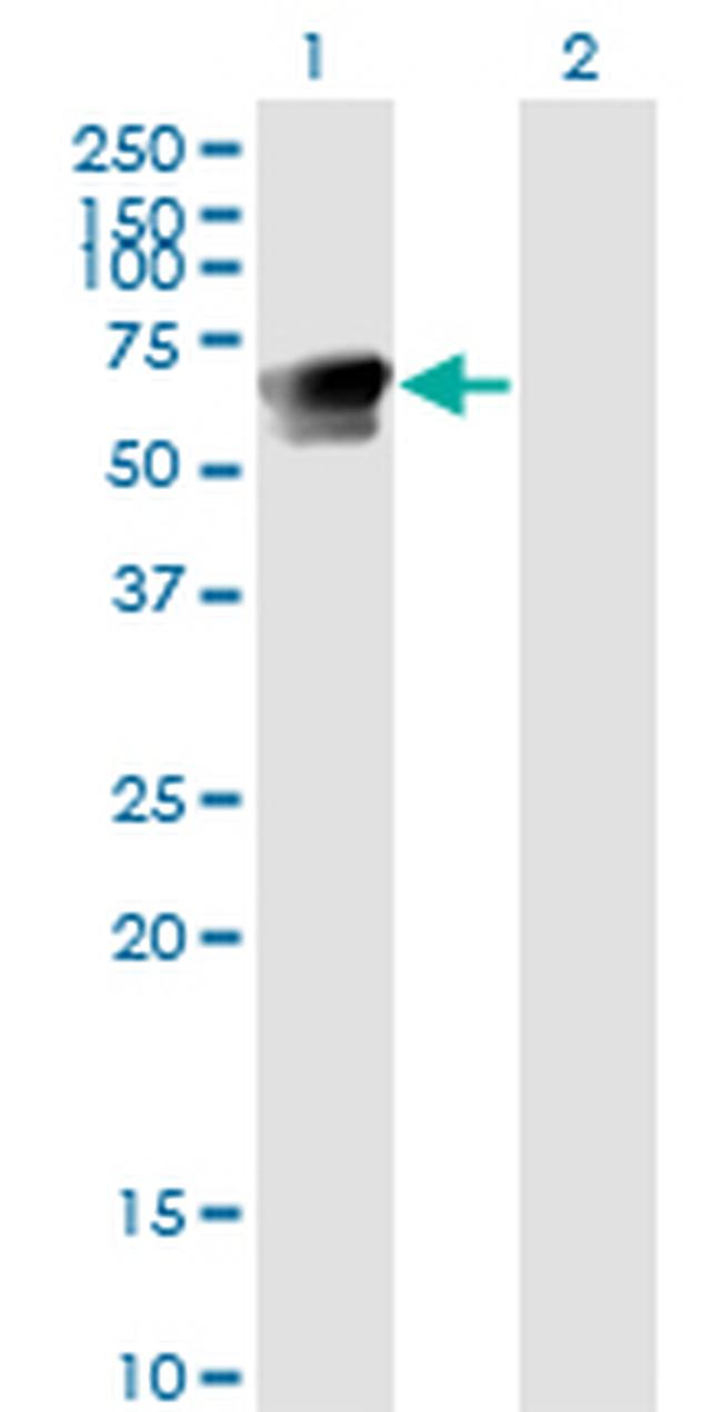 GRB7 Antibody in Western Blot (WB)