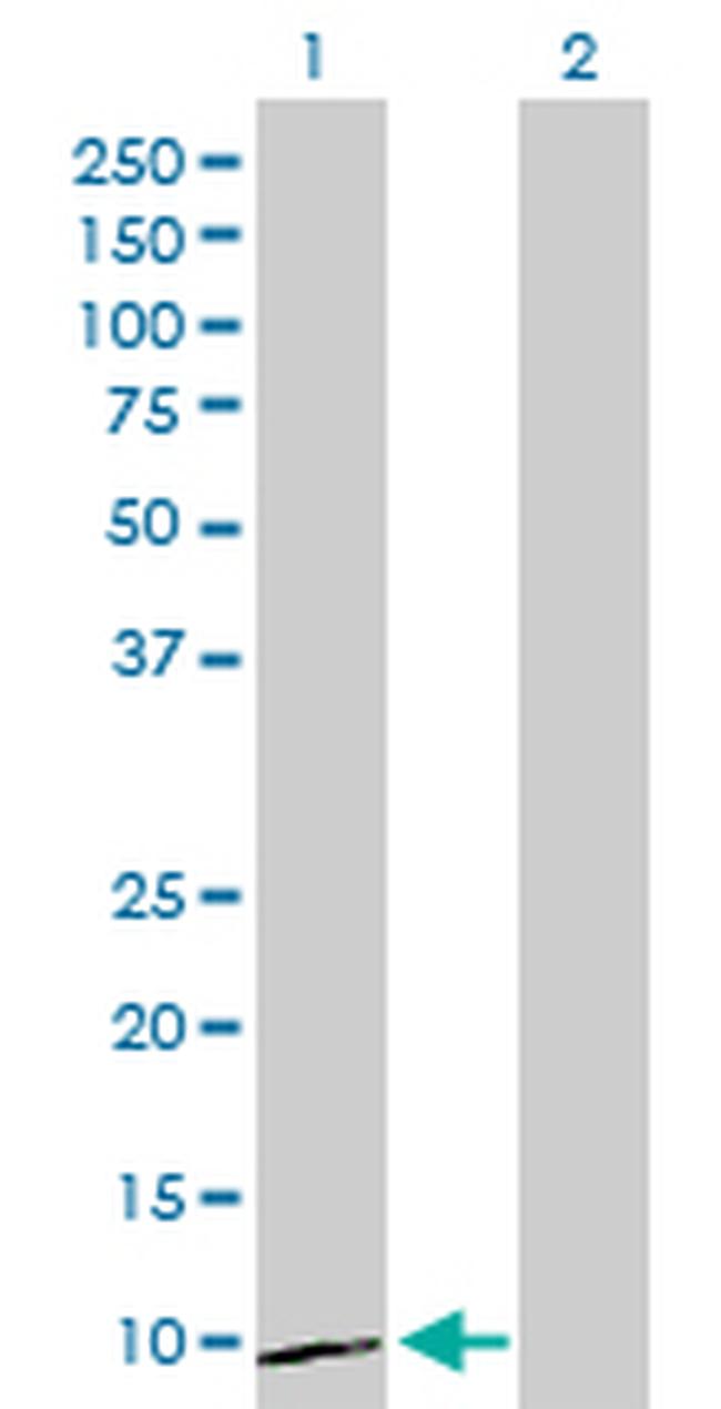 CXCL1 Antibody in Western Blot (WB)