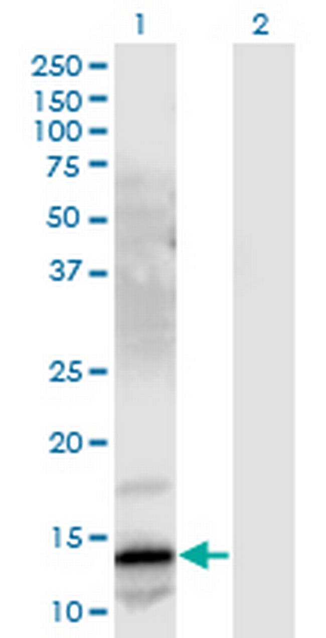 GRP Antibody in Western Blot (WB)
