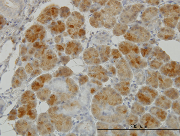 GSR Antibody in Immunohistochemistry (Paraffin) (IHC (P))