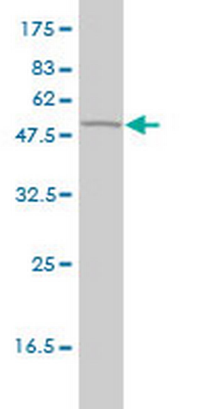 GSS Antibody in Western Blot (WB)
