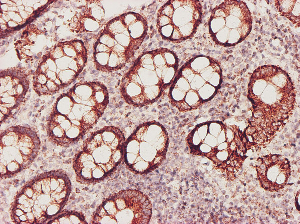 GSS Antibody in Immunohistochemistry (Paraffin) (IHC (P))