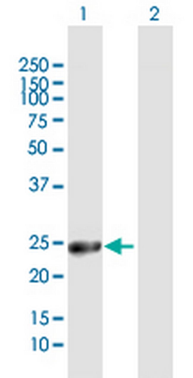 GSTA1 Antibody in Western Blot (WB)