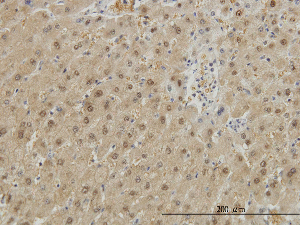 GSTA1 Antibody in Immunohistochemistry (Paraffin) (IHC (P))