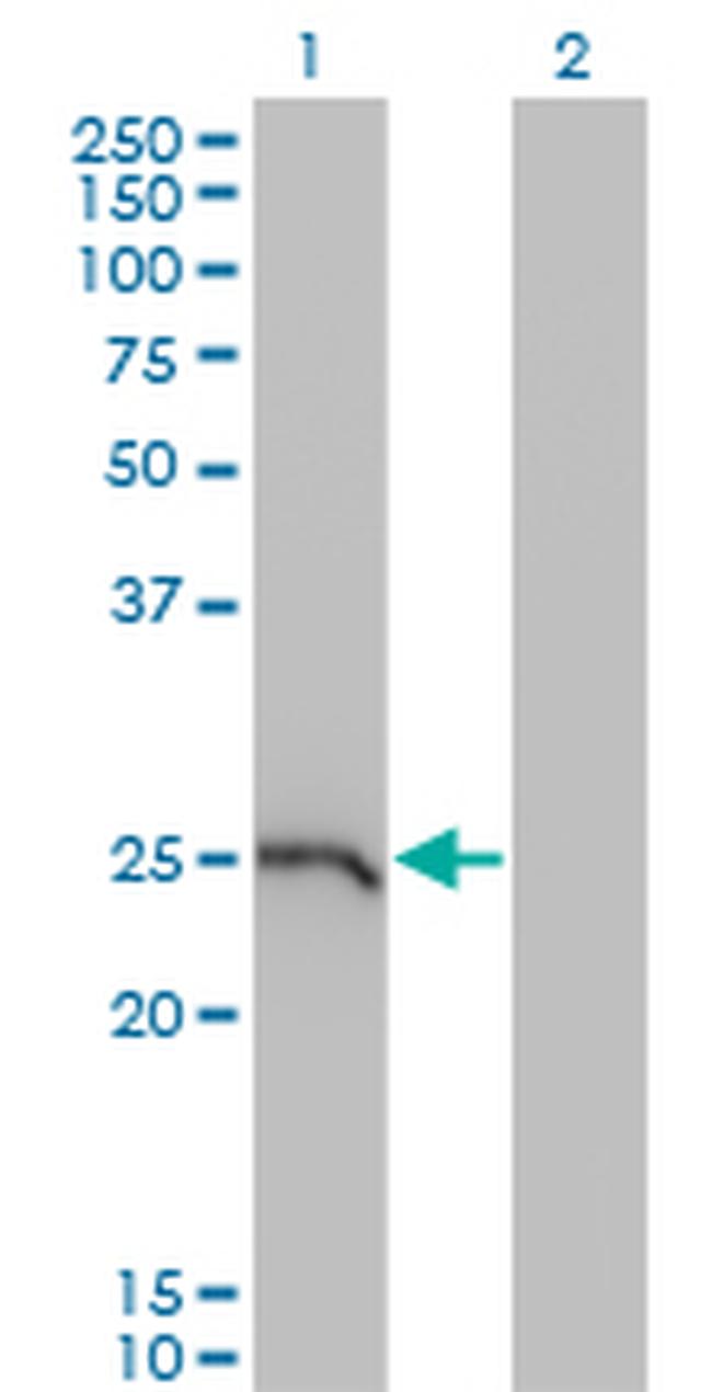 GSTA1 Antibody in Western Blot (WB)