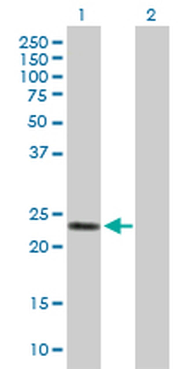 GSTA2 Antibody in Western Blot (WB)