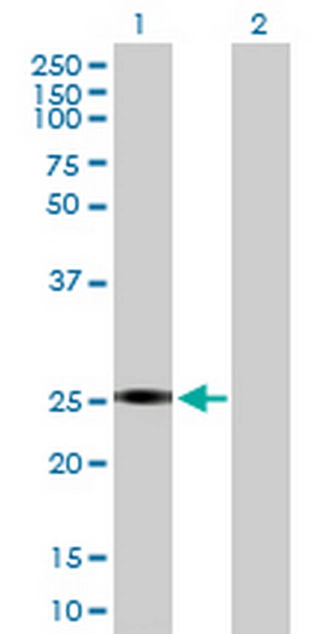 GSTA2 Antibody in Western Blot (WB)
