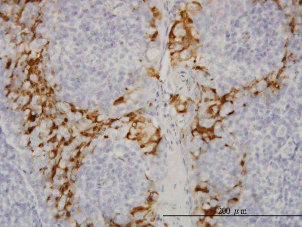 GSTA3 Antibody in Immunohistochemistry (Paraffin) (IHC (P))