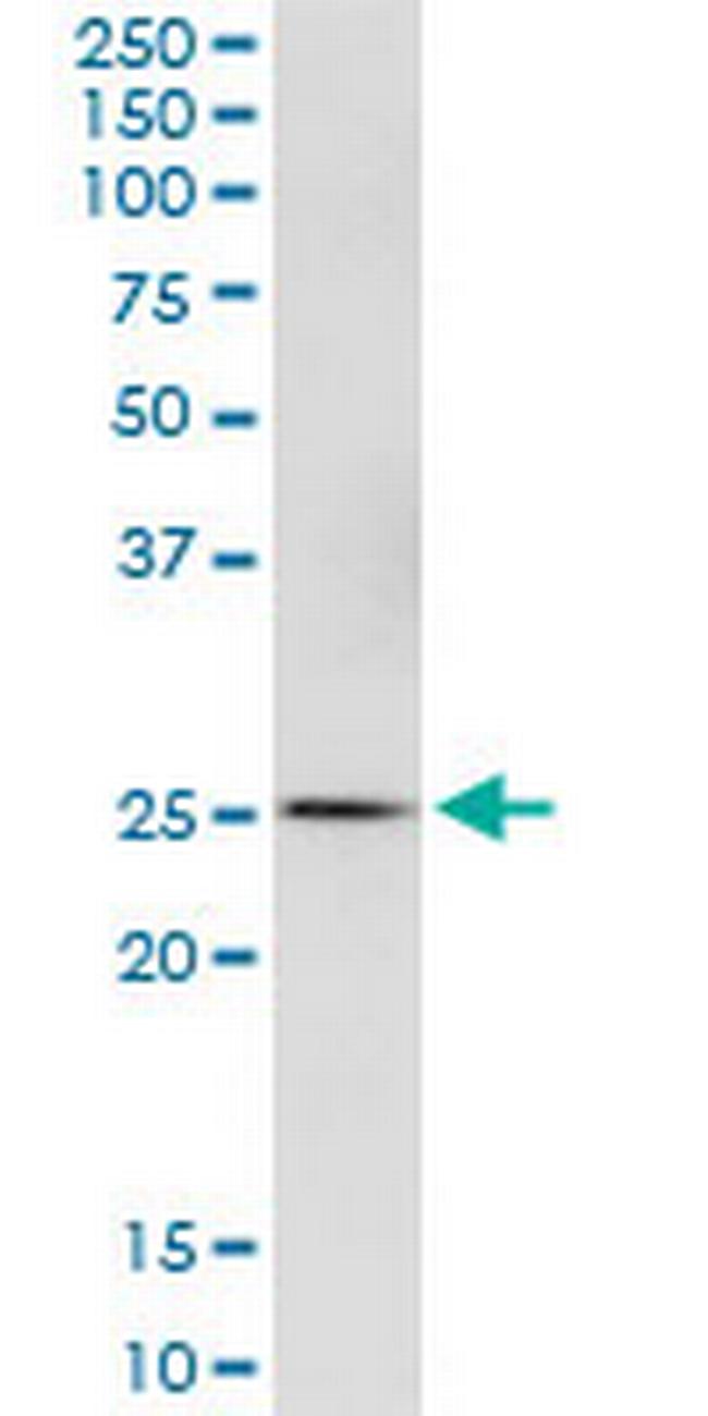 GSTA4 Antibody in Western Blot (WB)