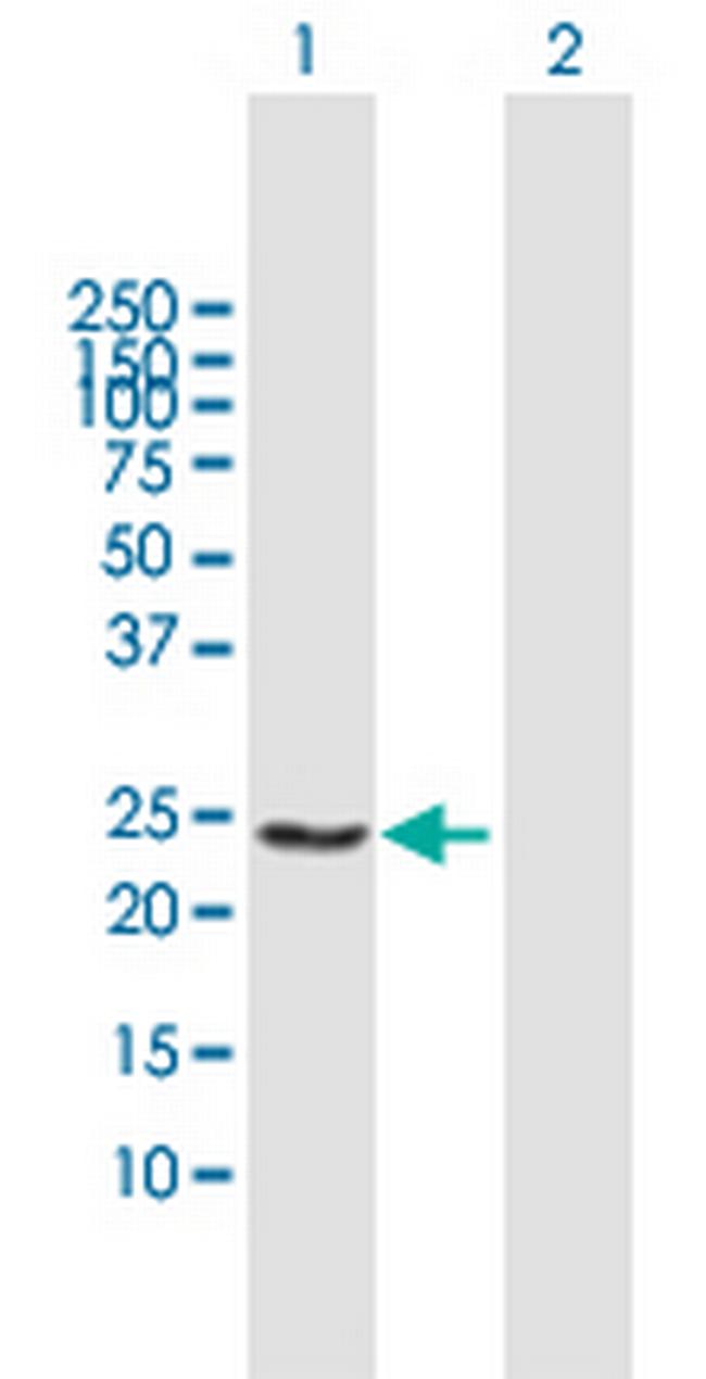 GSTA4 Antibody in Western Blot (WB)