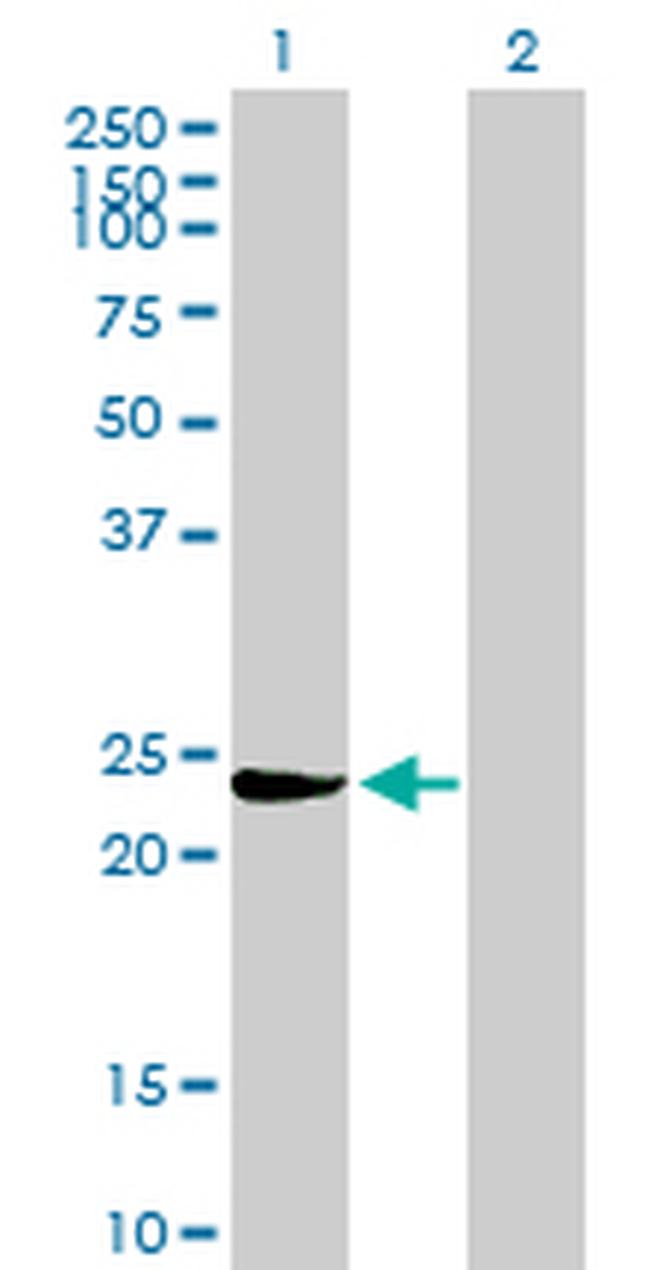 GSTM3 Antibody in Western Blot (WB)