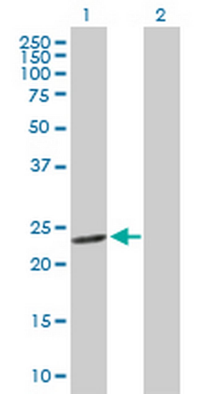 GSTM4 Antibody in Western Blot (WB)