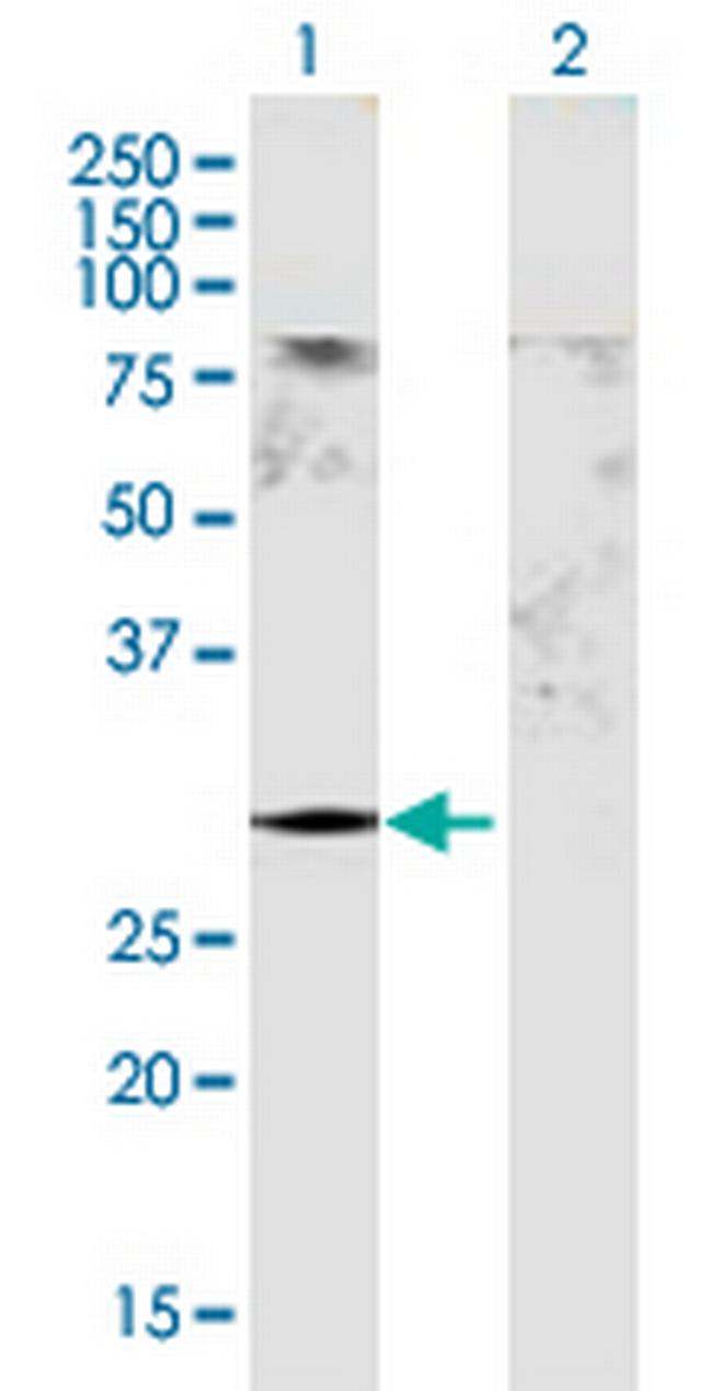 GSTM5 Antibody in Western Blot (WB)