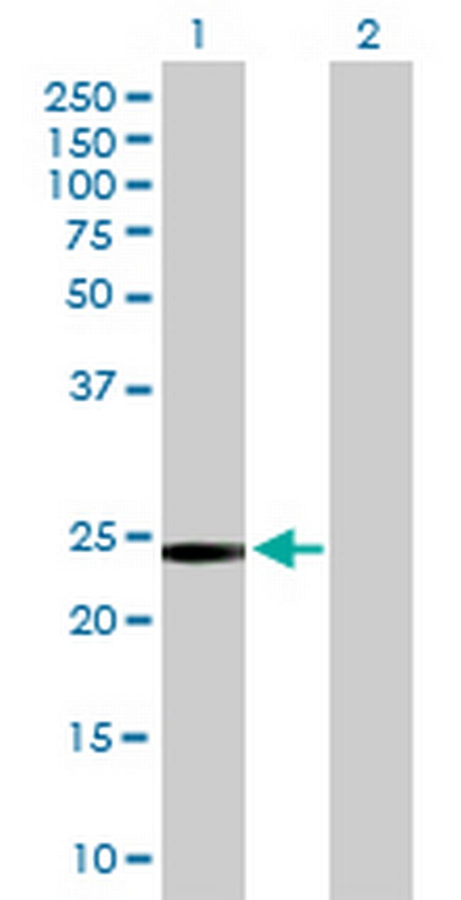 GSTT2 Antibody in Western Blot (WB)