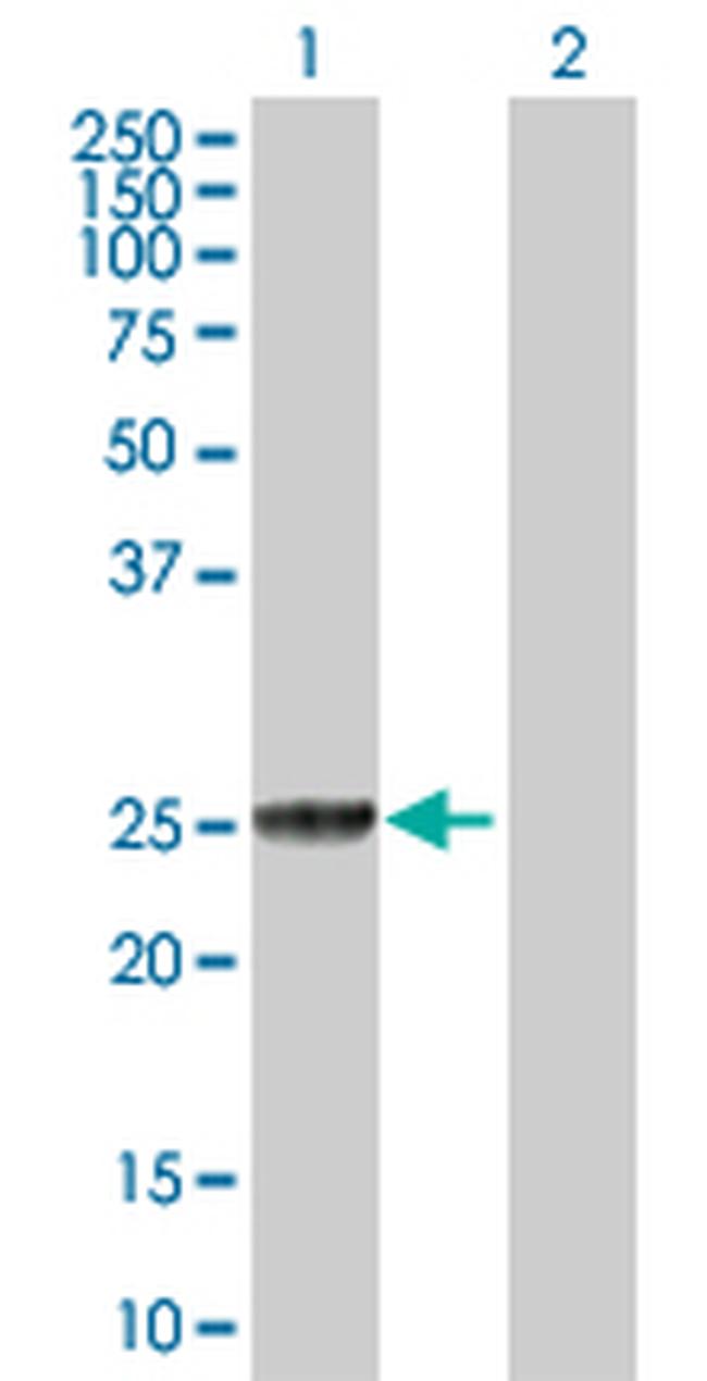 GSTT2 Antibody in Western Blot (WB)