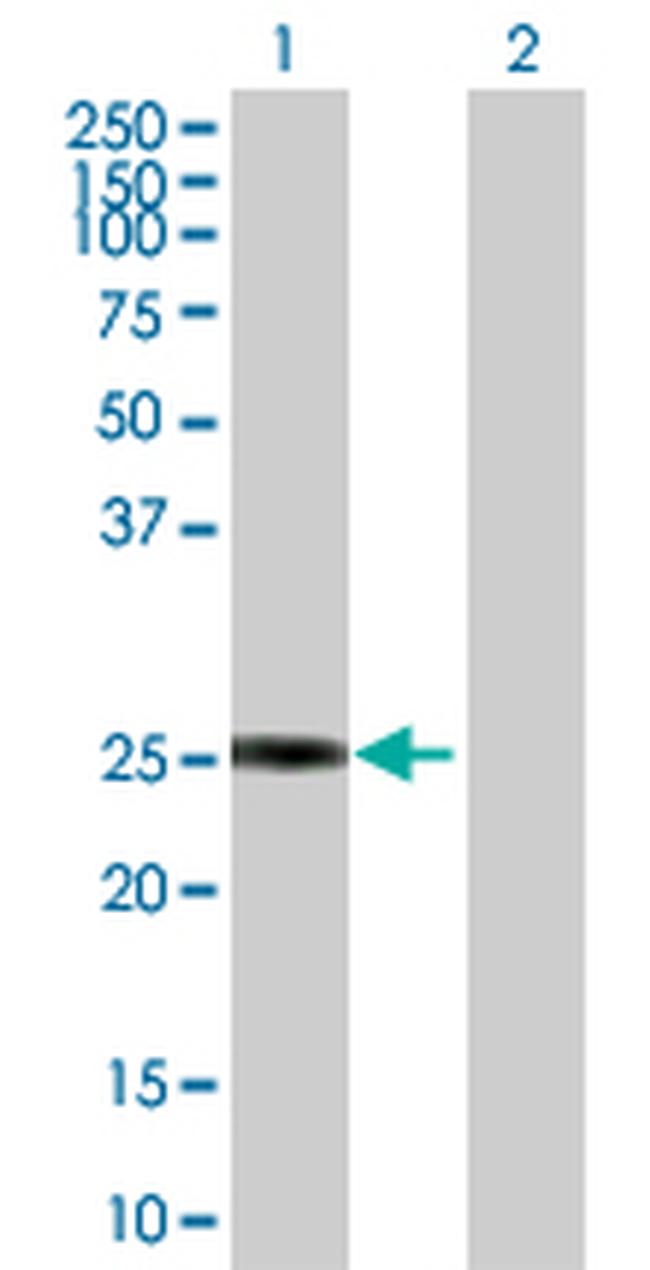 GSTZ1 Antibody in Western Blot (WB)