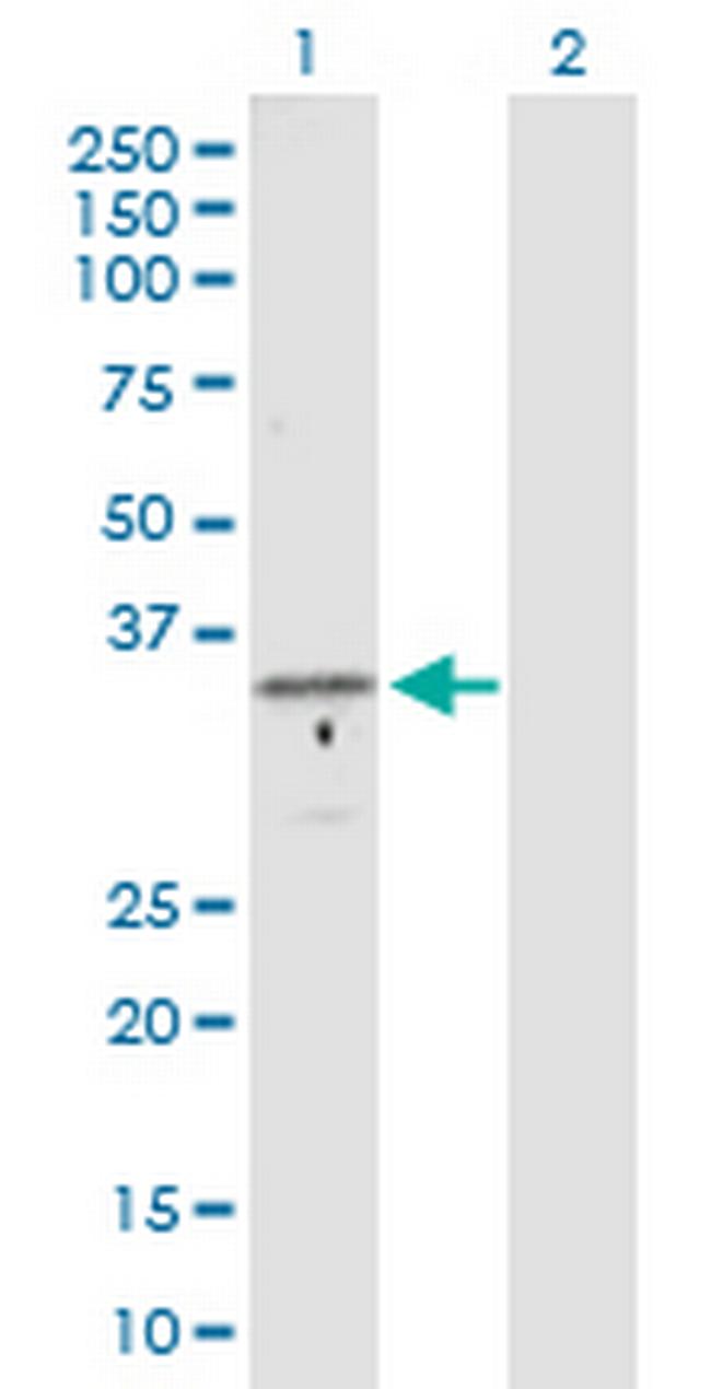 GTF2B Antibody in Western Blot (WB)