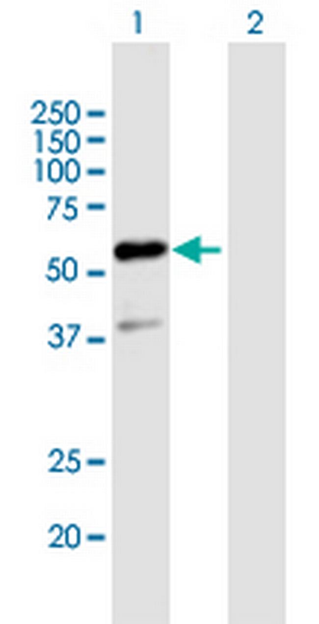 GTF2E1 Antibody in Western Blot (WB)
