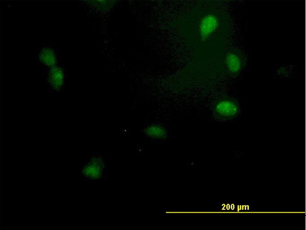 GTF2E2 Antibody in Immunocytochemistry (ICC/IF)