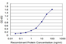 GTF2H1 Antibody in ELISA (ELISA)