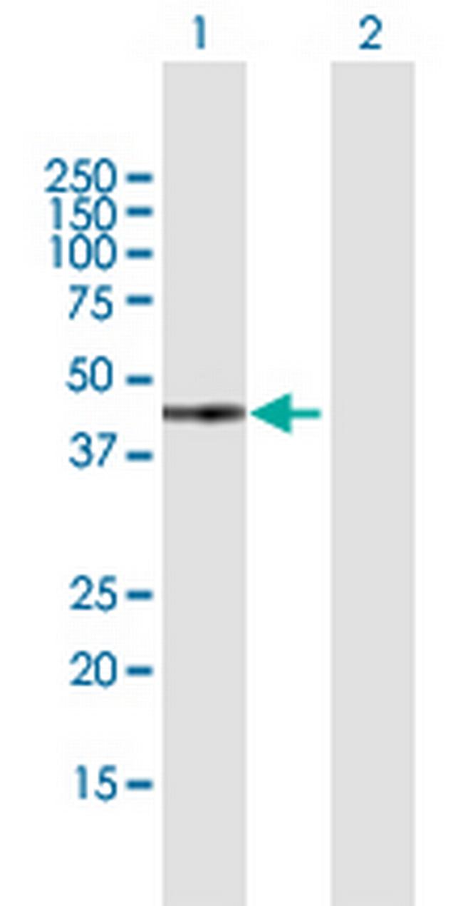 GTF2H2 Antibody in Western Blot (WB)