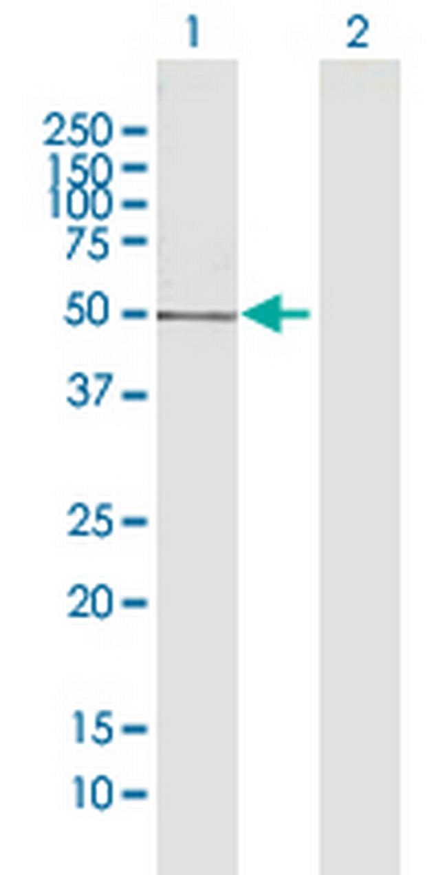 GTF2H2 Antibody in Western Blot (WB)