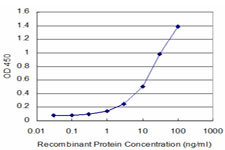 GTF3A Antibody in ELISA (ELISA)
