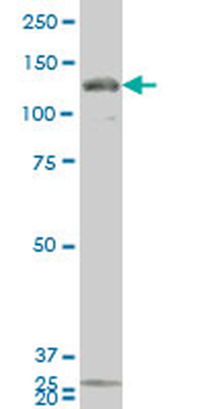 GUCY2C Antibody in Western Blot (WB)