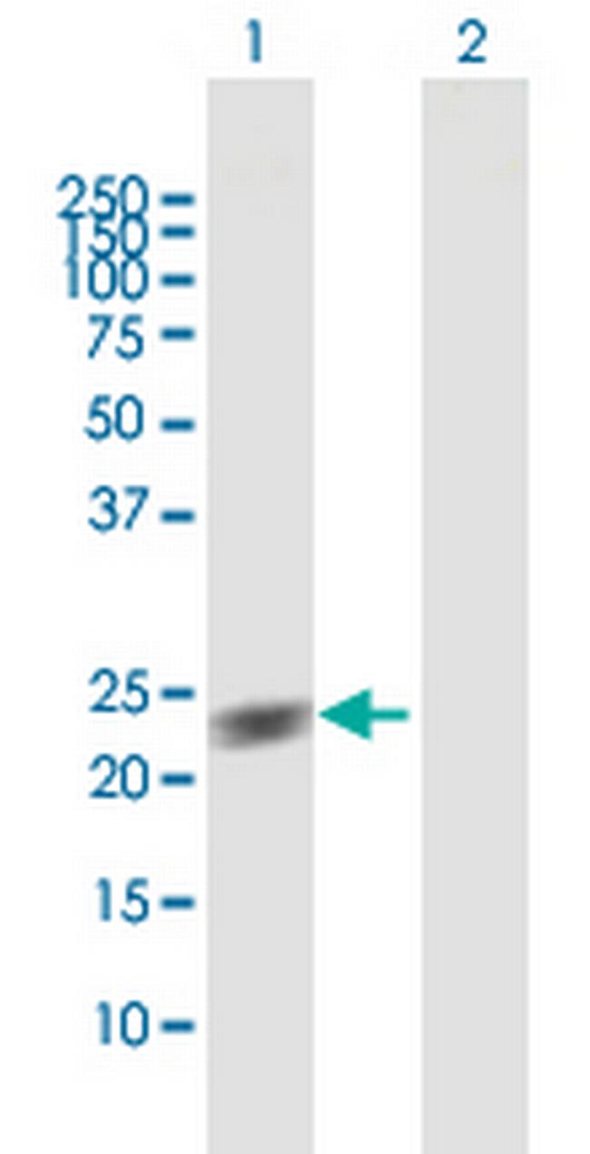 GUK1 Antibody in Western Blot (WB)