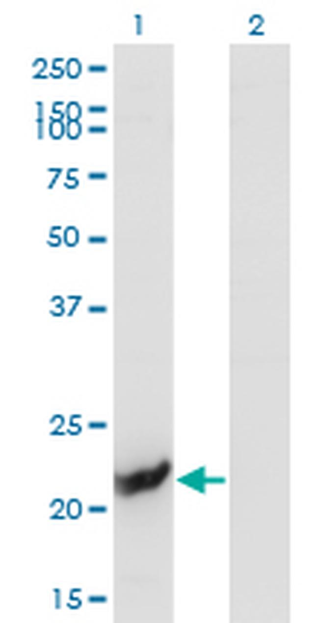 GUK1 Antibody in Western Blot (WB)
