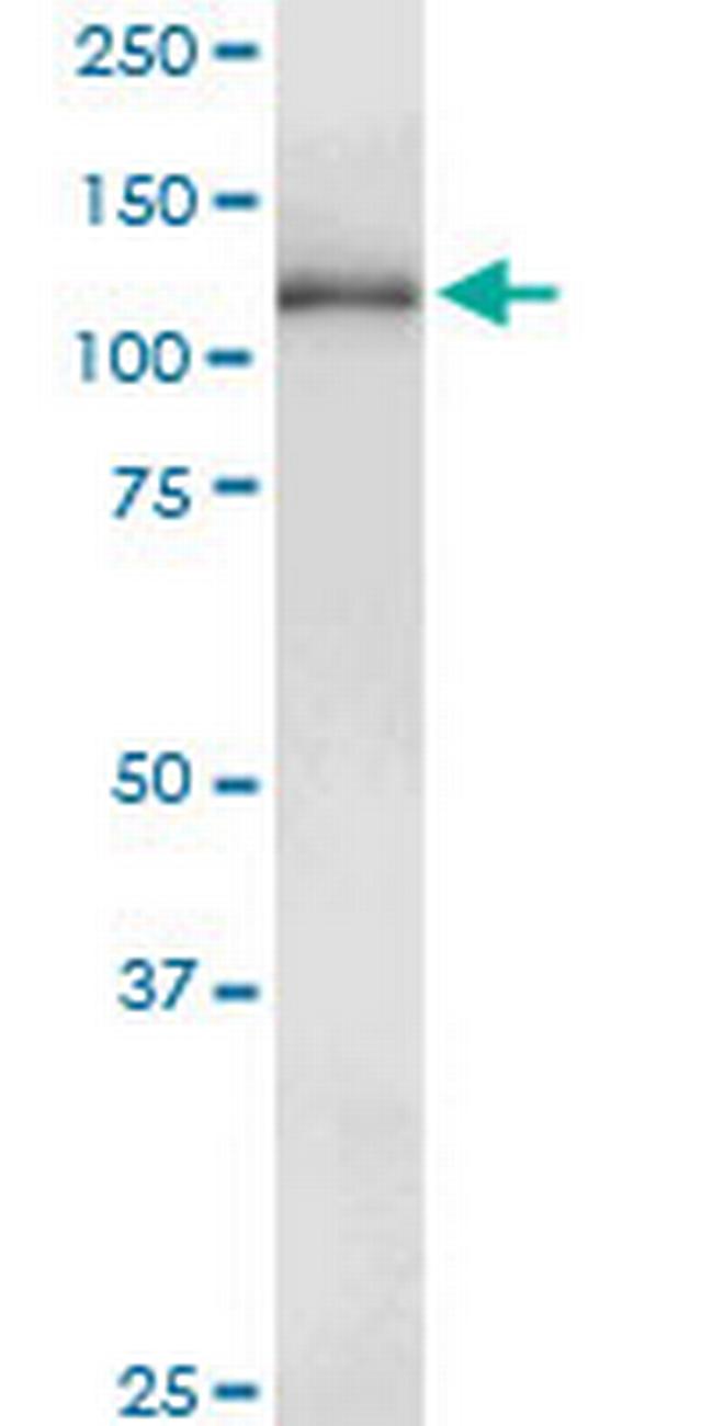GUCY2D Antibody in Western Blot (WB)