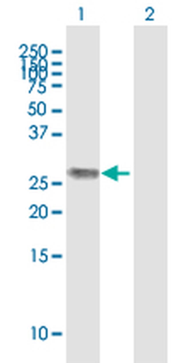 H1F0 Antibody in Western Blot (WB)