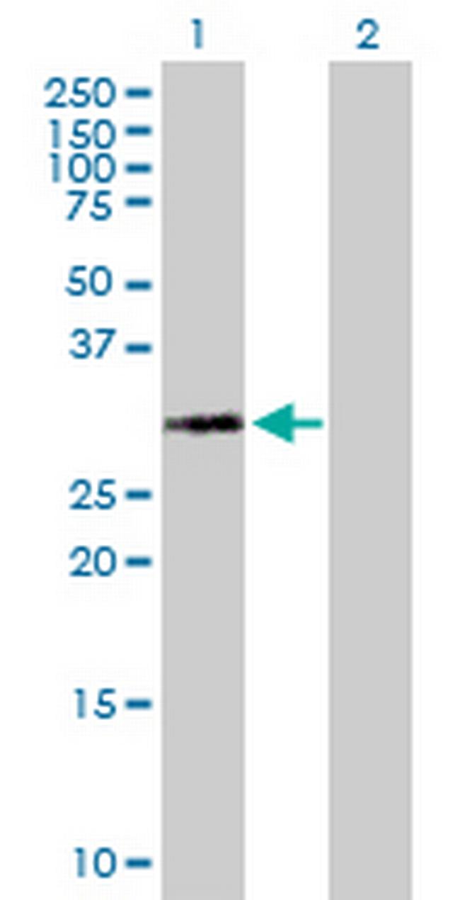 HIST1H1A Antibody in Western Blot (WB)