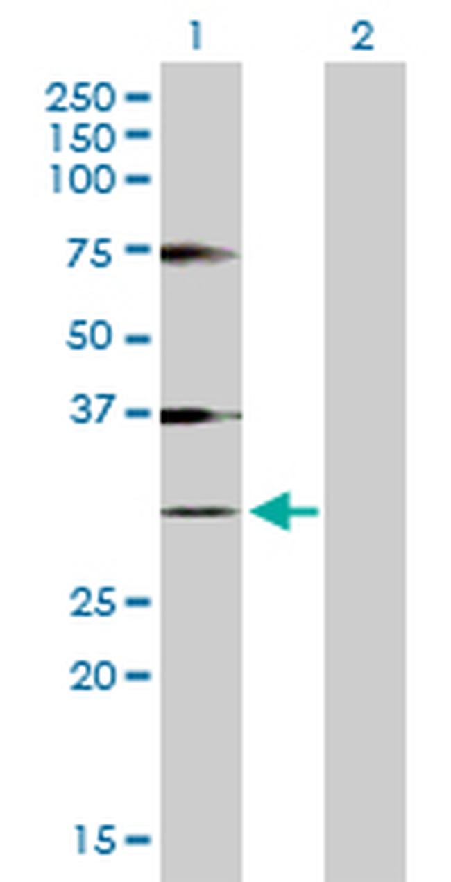 HIST1H1A Antibody in Western Blot (WB)