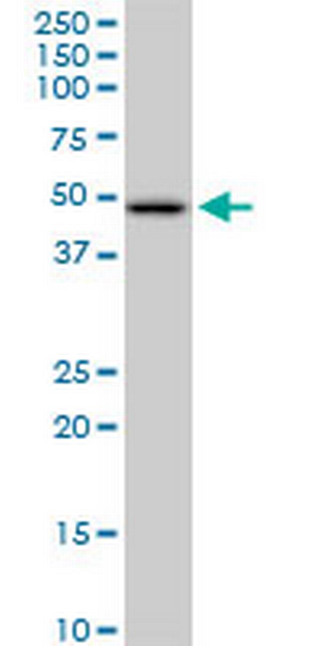 HADHB Antibody in Western Blot (WB)