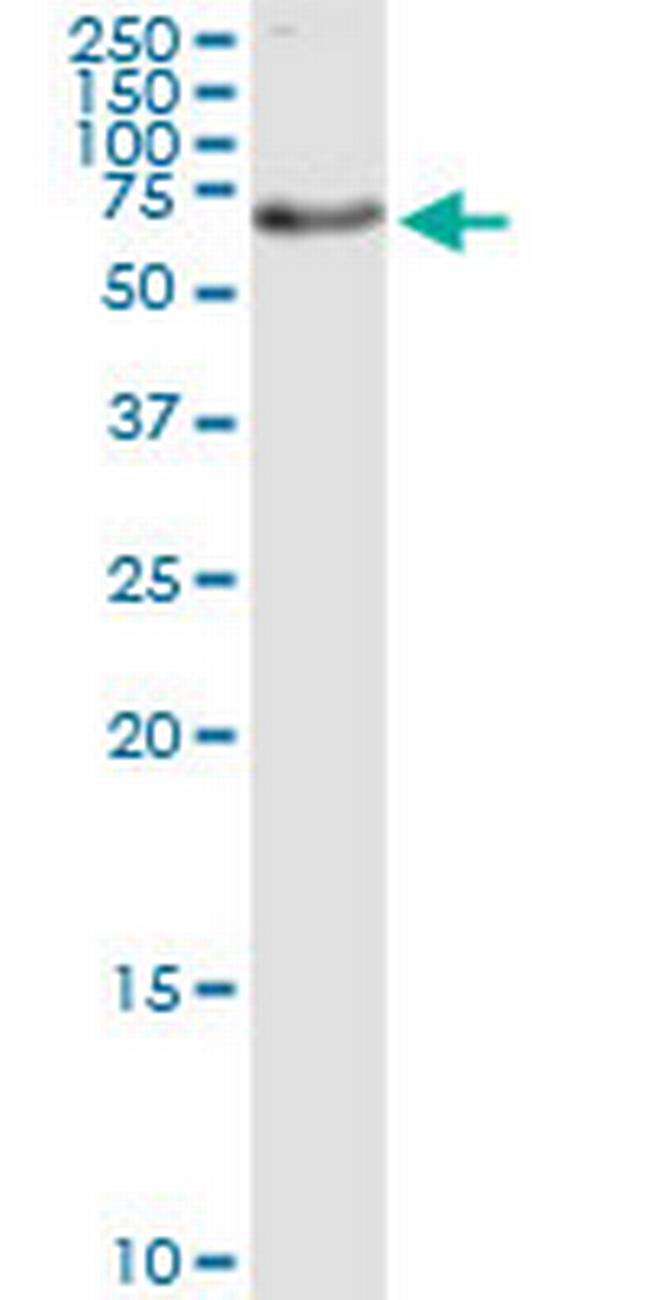 HADHB Antibody in Western Blot (WB)