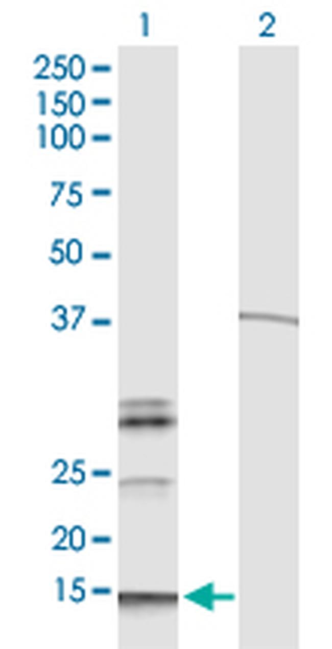 HBG1 Antibody in Western Blot (WB)