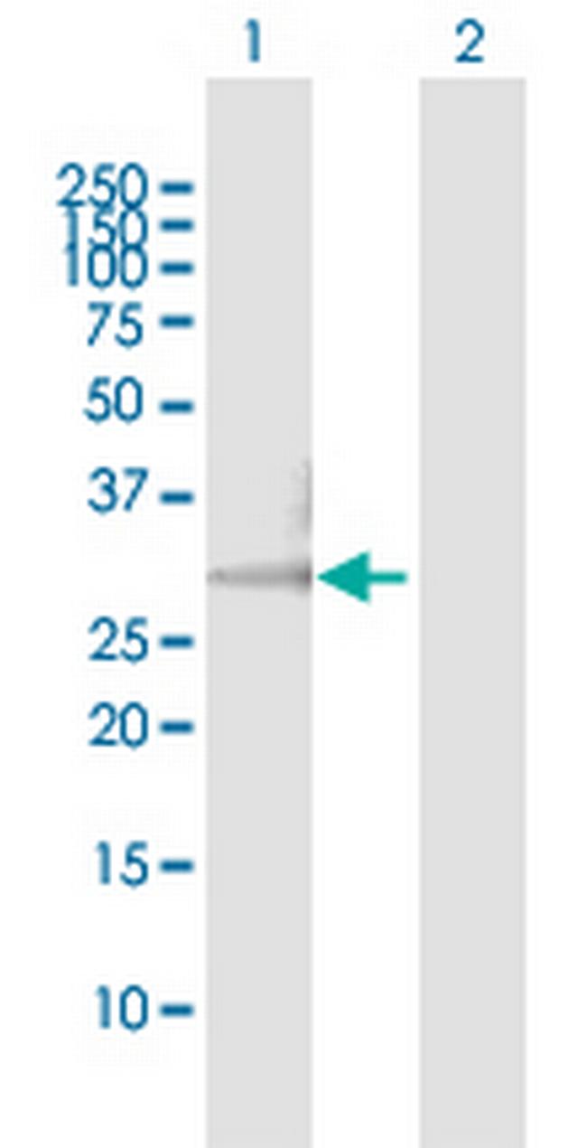 HCCS Antibody in Western Blot (WB)